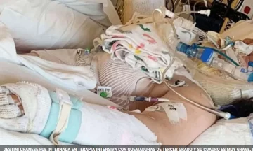 Tiene 13 años, quiso cumplir un peligroso reto viral de TikTok y sufrió quemaduras de tercer grado Tiene 13 años, quiso cumplir un peligroso reto viral de TikTok y sufrió quemaduras de tercer grado