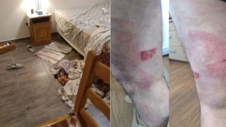 Robaron y torturaron a un matrimonio: “Te corto los dedos si no me das la guita” Robaron y torturaron a un matrimonio: “Te corto los dedos si no me das la guita”