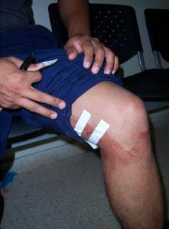 Un joven llegó baleado al hospital y dijo que quisieron robarle Un joven llegó baleado al hospital y dijo que quisieron robarle