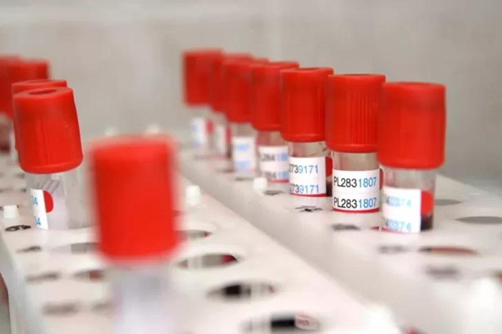 Rusia anunció la fecha de registro de la primera vacuna contra el coronavirus