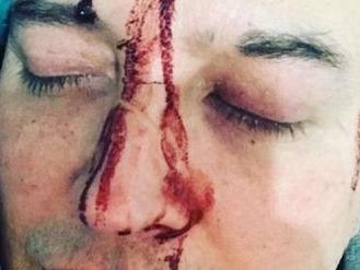 Filtraron el video del brutal ataque a Leo García Filtraron el video del brutal ataque a Leo García