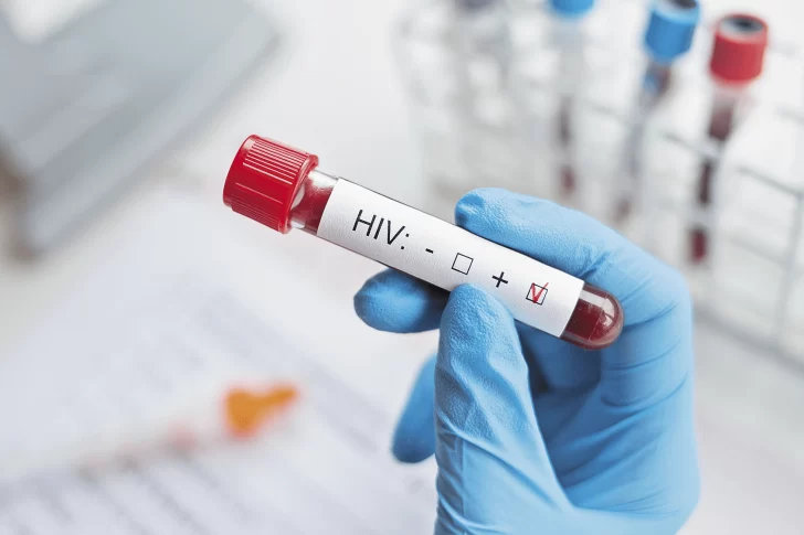 Una mujer dejó atrás el VIH con un tratamiento con sangre de cordón umbilical