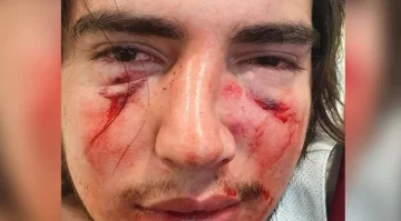Difunden un video del joven golpeado por rugbiers agrediendo a un remisero Difunden un video del joven golpeado por rugbiers agrediendo a un remisero