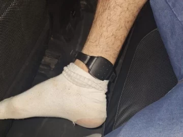 Un ladrón con pulsera electrónica desfiguró a un hombre para robarle el celular y lo atraparon