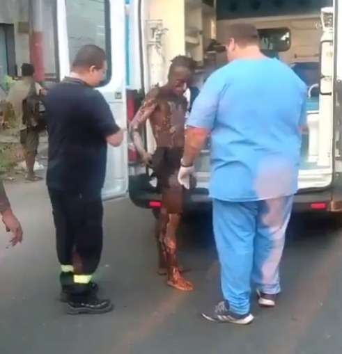 Quedó con el 90% del cuerpo quemado tras intentar robar cables de electricidad en Rosario Quedó con el 90% del cuerpo quemado tras intentar robar cables de electricidad en Rosario