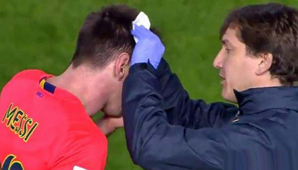 Messi sufrió un corte tras recibir el impacto de una botella Messi sufrió un corte tras recibir el impacto de una botella