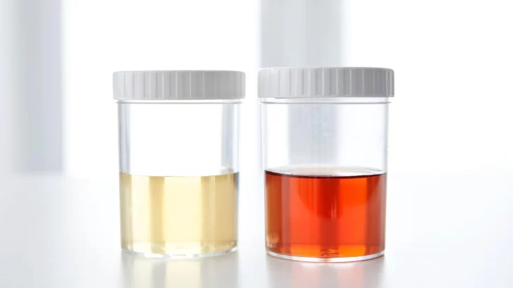 En-un-extremo-del-espectro-esta-la-orina-incolora-728x409