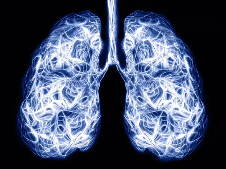 Cómo es el tratamiento para el cáncer de pulmón que prolonga la vida de los pacientes Cómo es el tratamiento para el cáncer de pulmón que prolonga la vida de los pacientes