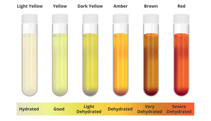 que-significa-el-color-de-la-orina-728x419