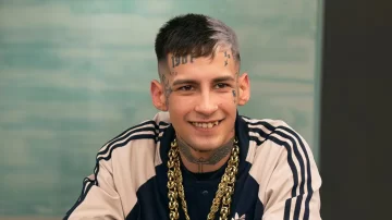 L-Gante se arregló la dentadura y presumió su nueva sonrisa L-Gante se arregló la dentadura y presumió su nueva sonrisa