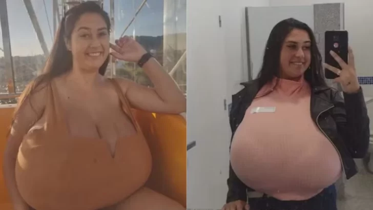 La pesadilla de vivir con gigantomastia: “Mis senos crecieron 10 kilos en unos meses” La pesadilla de vivir con gigantomastia: “Mis senos crecieron 10 kilos en unos meses”