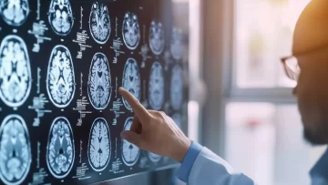 Cómo prevenir la migraña: 10 alimentos que deberías evitar Cómo prevenir la migraña: 10 alimentos que deberías evitar