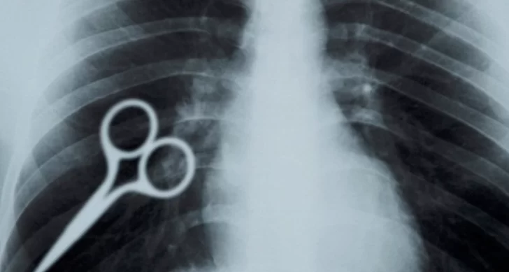 Un preso se tragó una tijera como acto de protesta y debió ser hospitalizado Un preso se tragó una tijera como acto de protesta y debió ser hospitalizado