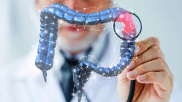 Cáncer de colon: cómo es el test simple e innovador que evitaría la colonoscopia Cáncer de colon: cómo es el test simple e innovador que evitaría la colonoscopia