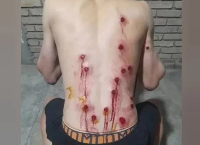 El policía que baleó por la espalda a un joven enfrentaría los delitos más graves