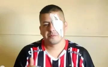 Un hincha denunció a Patricia Bullrich tras perder un ojo por la represión en el Congreso