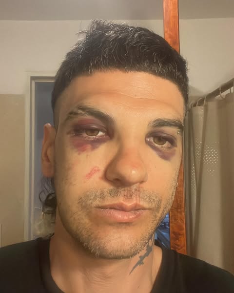 El propio Salvalaggio confirmó que el ataque a su persona fue “mandado” y dio nombres El propio Salvalaggio confirmó que el ataque a su persona fue “mandado” y dio nombres