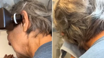 Una mujer sintió que algo caminaba en el oído, se tiró agua en el interior y descubrió lo peor Una mujer sintió que algo caminaba en el oído, se tiró agua en el interior y descubrió lo peor