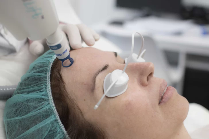 El tratamiento con láser CO2