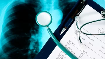 Primer registro nacional de una enfermedad respiratoria crónica poco diagnosticada