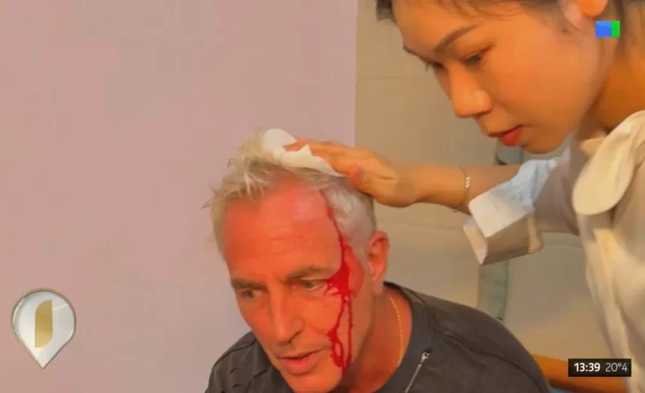 marley-accidente-golpe-la-cabeza-3-728x443 marley-accidente-golpe-la-cabeza-3-728x443