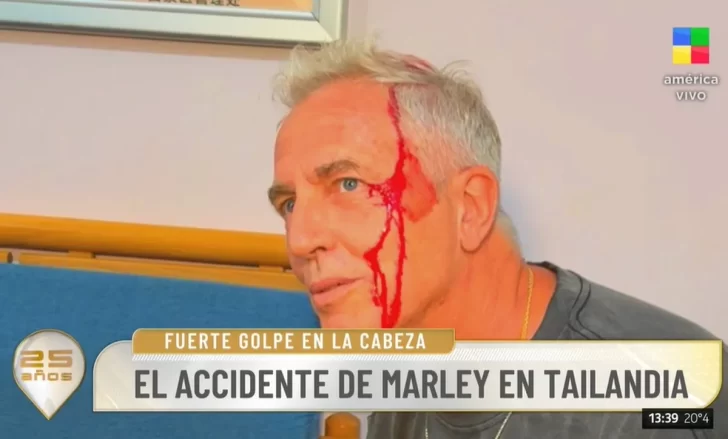 marley-accidente-golpe-la-cabeza-728x439 marley-accidente-golpe-la-cabeza-728x439