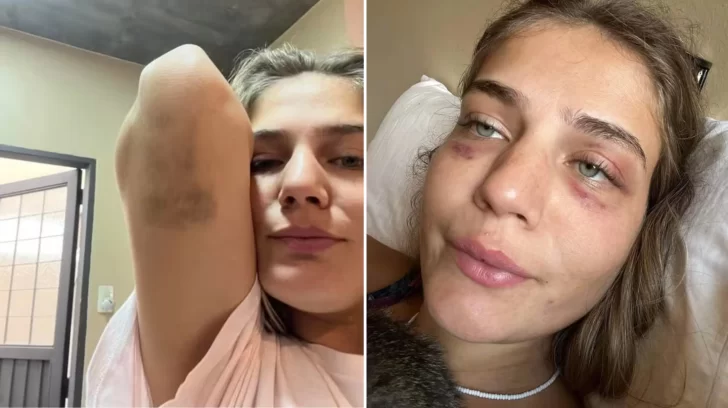 modelo-brasil-denuncia-violencia-728x408 modelo-brasil-denuncia-violencia-728x408