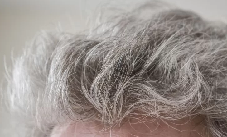 Cómo usar el vinagre de manzana para eliminar las canas Cómo usar el vinagre de manzana para eliminar las canas