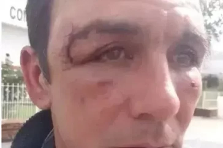 Arranca el juicio a 3 policías por golpear a un hombre ebrio que paró para no chocar