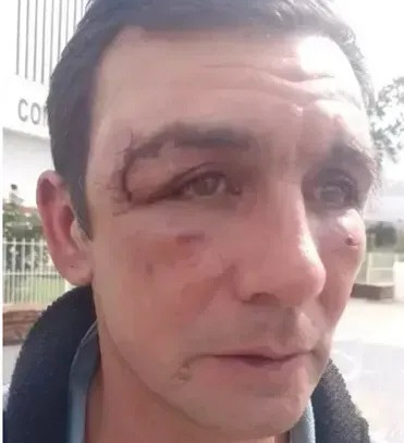 Arranca el juicio a 3 policías por golpear a un hombre ebrio que paró para no chocar