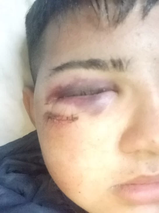 Violenta pelea entre dos familias: “Mi hijo no ve nada de un ojo, fue un intento de homicidio lo que hicieron contra nosotros” Violenta pelea entre dos familias: “Mi hijo no ve nada de un ojo, fue un intento de homicidio lo que hicieron contra nosotros”