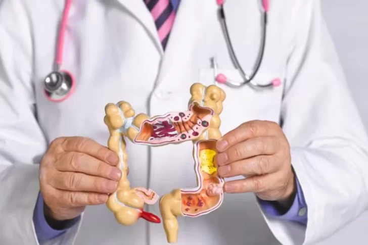 Q-FIT, el test que permite detectar el cáncer de colon de manera temprana y sin procedimientos invasivos