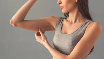 Expertos explicaron por qué la grasa en los brazos es difícil de eliminar