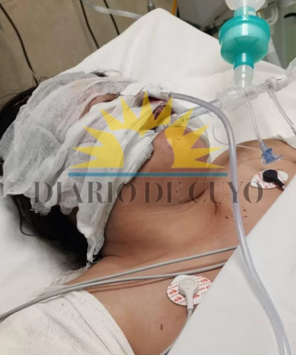 danisa-aveiro-internacion-1-606x728