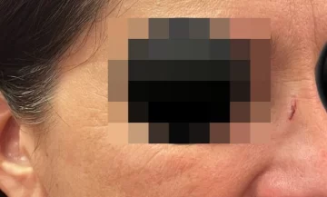 Cuatro meses de prisión condicional para la mujer que agredió a una docente Cuatro meses de prisión condicional para la mujer que agredió a una docente