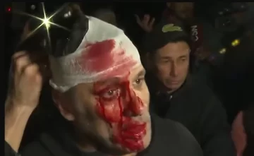 Incidentes en el acto de LLA: peleas entre militantes, un botellazo a un periodista y piedras al auto presidencial