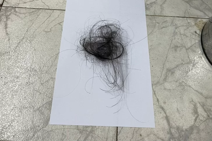 La terrible agresión a una docente: la alumna le arrancó mechones de pelo y la madre le pegó una trompada