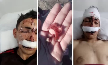 Salvaje ataque: dos hermanos golpearon a un joven hasta desfigurarlo frente a su hijo de 7 años Salvaje ataque: dos hermanos golpearon a un joven hasta desfigurarlo frente a su hijo de 7 años