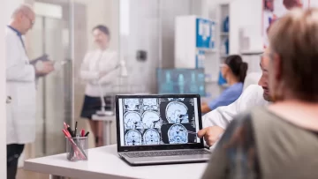 Día Mundial del Accidente Cerebrovascular: en Argentina cada 40 segundos una persona sufre un ACV