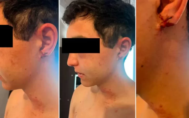 La gravísima denuncia de un trabajador rural torturado por sus jefes: “Me sacaron la oreja con los dientes” La gravísima denuncia de un trabajador rural torturado por sus jefes: “Me sacaron la oreja con los dientes”