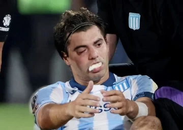 Santiago Sosa sufrió una fractura en su rostro tras el codazo que recibió de Marcos Rojo Santiago Sosa sufrió una fractura en su rostro tras el codazo que recibió de Marcos Rojo