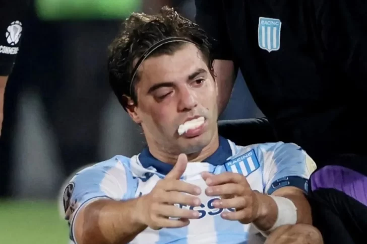 Santiago Sosa sufrió una fractura en su rostro tras el codazo que recibió de Marcos Rojo
