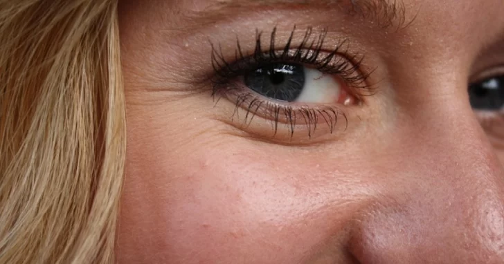 Medicina, ejercicios, dieta y cuidados: cómo eliminar las patas de gallo