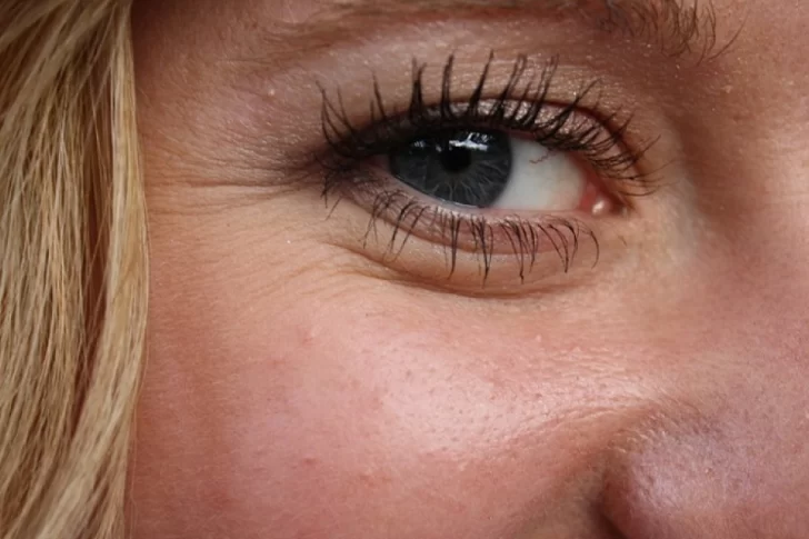 Medicina, ejercicios, dieta y cuidados: cómo eliminar las patas de gallo