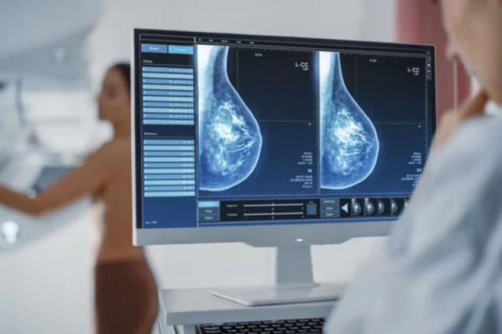 Cáncer de mama: cambian la edad en la que se debe hacer la primera mamografía