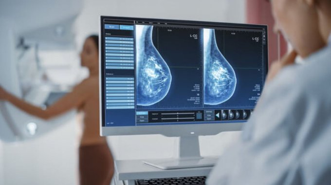 Cáncer de mama: cambian la edad en la que se debe hacer la primera mamografía