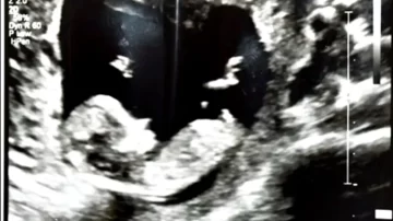 Captura-de-pantalla-2025-11-04-143741-728x408