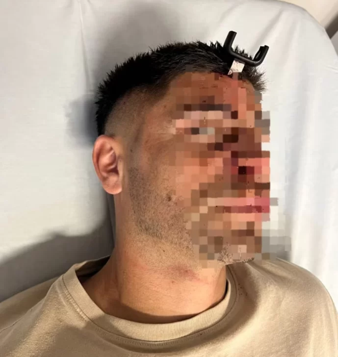 Lo apuñalaron con una llave en la cabeza, luchó por su vida y después de cinco días le dieron el alta Lo apuñalaron con una llave en la cabeza, luchó por su vida y después de cinco días le dieron el alta
