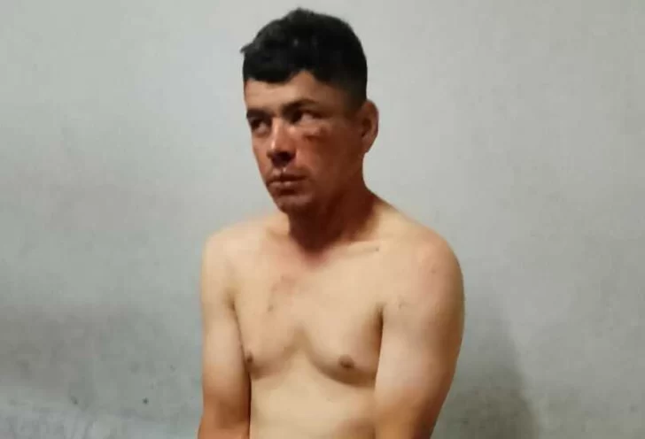 Aprehenden a un hombre que quiso robar en una concesionaria y atacó a un policía Aprehenden a un hombre que quiso robar en una concesionaria y atacó a un policía