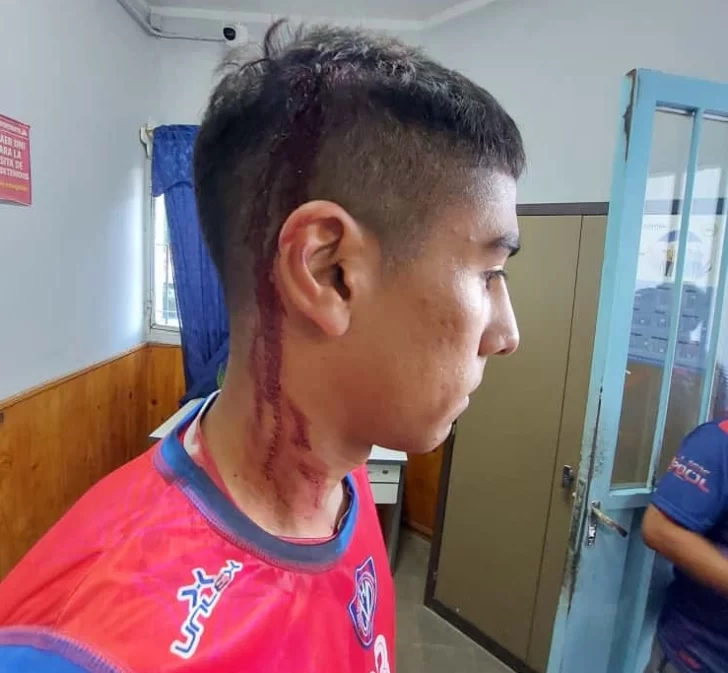 Violentos incidentes: jugadores de Villa Hipódromo fueron agredidos tras ganarle a Del Bono Violentos incidentes: jugadores de Villa Hipódromo fueron agredidos tras ganarle a Del Bono